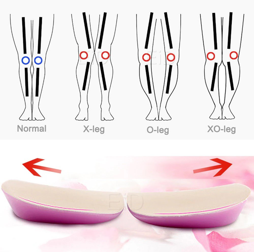 Orthopedic Shoes Insoles – Powerful Pain Relief & Comfort - Image 2