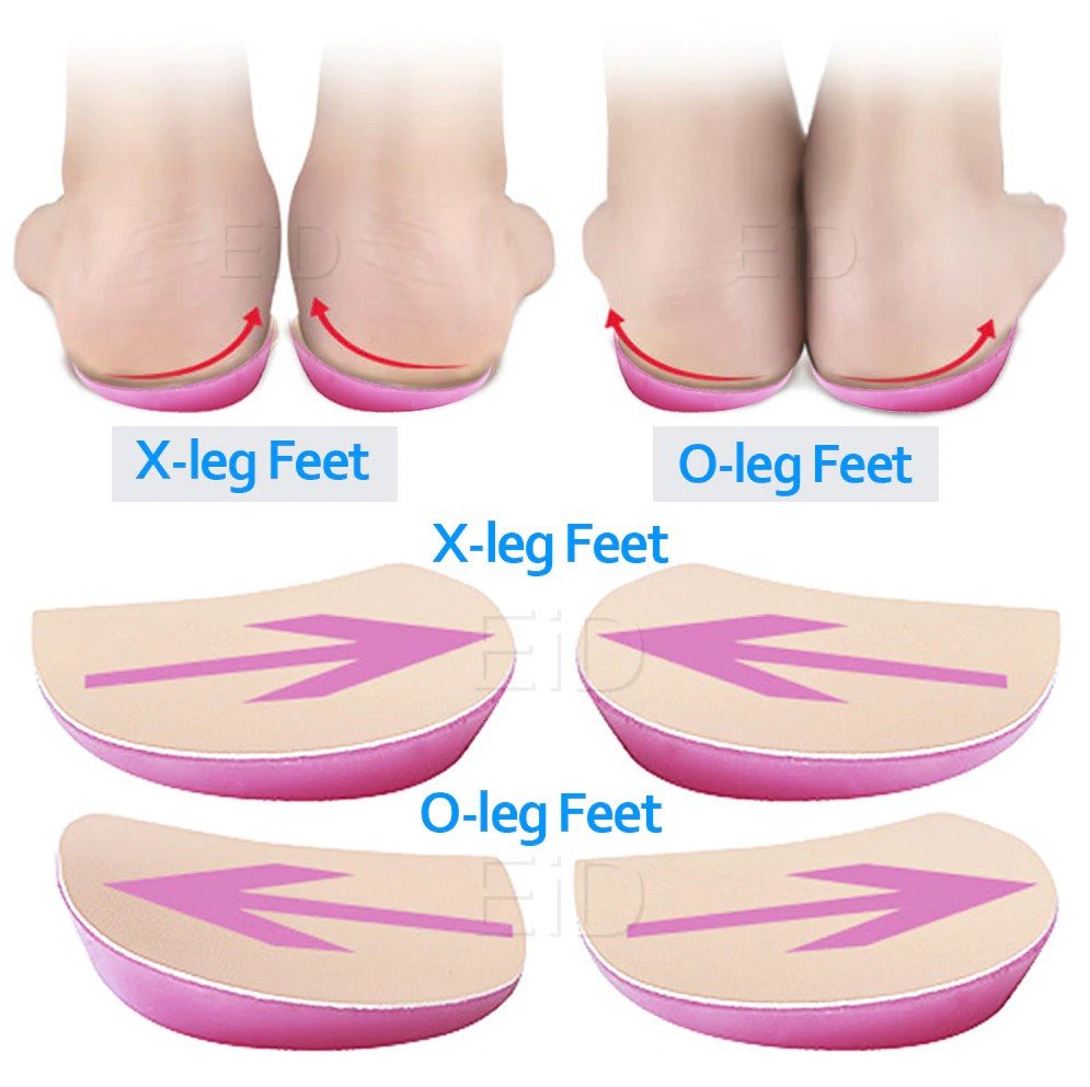 Orthopedic Shoes Insoles – Powerful Pain Relief & Comfort
