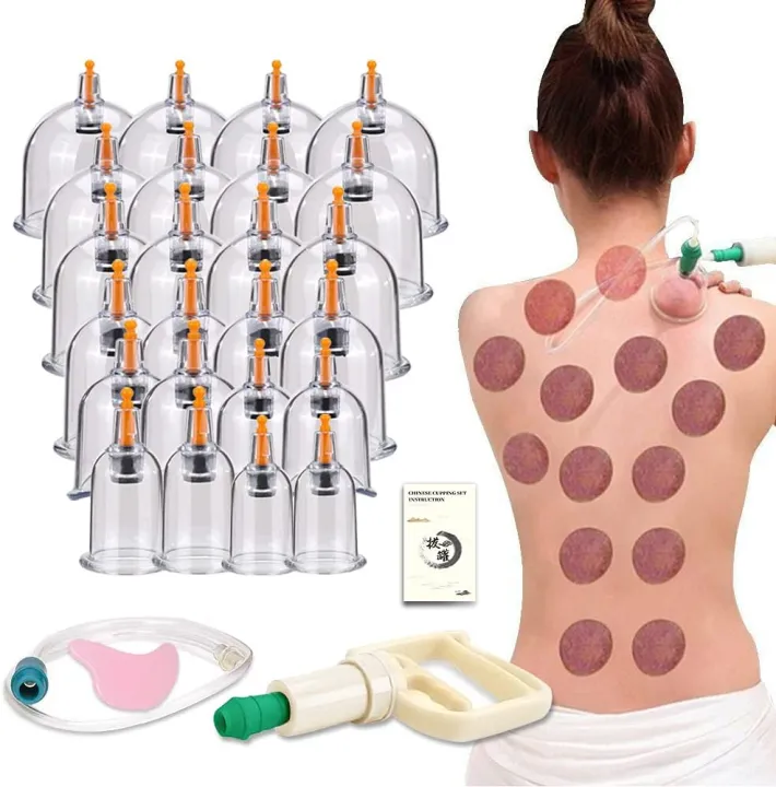 Hijama Cup Set 12 – Premium Cupping Therapy Kit for Pain Relief